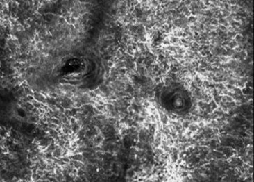 Reflectance Confocal Microscopy