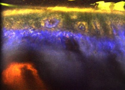 Cross-sectionally scanned multimodal microscopy