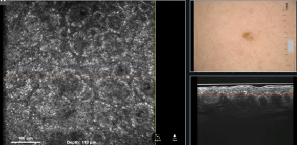 High-Resolution Full-Field OCT