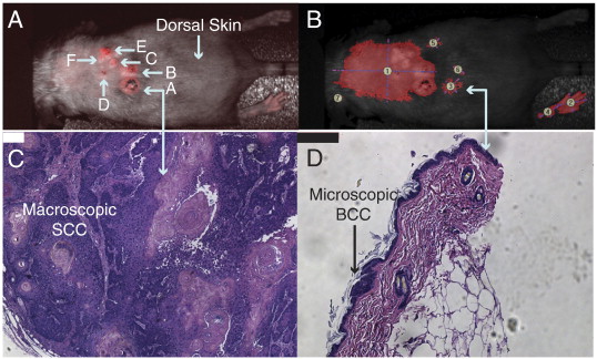 In vivo detection of macroscopic and microscopic NMSCs in the spontaneous P14 mouse